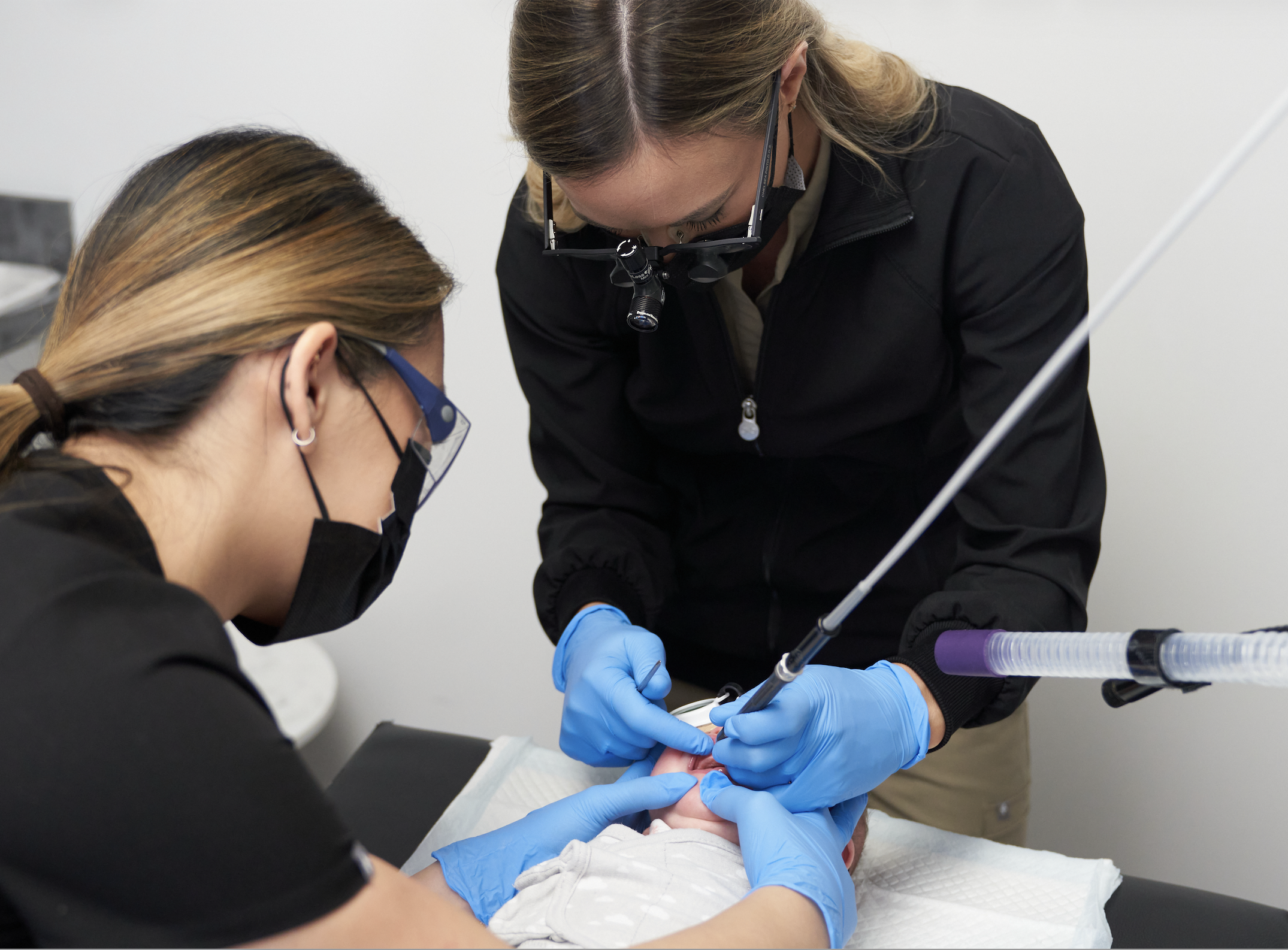 Tongue Tie & Frenectomy